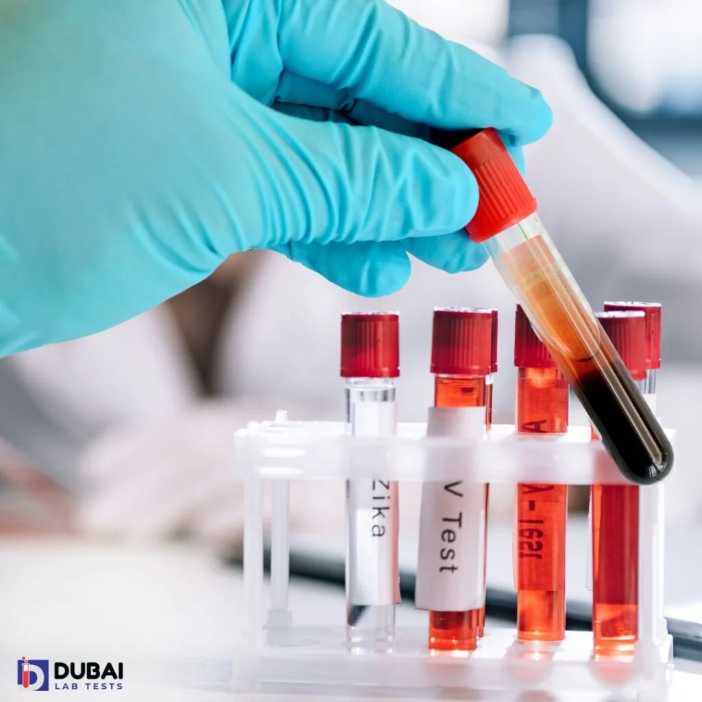 dubai lab test immunology large dubai lab test immunology large